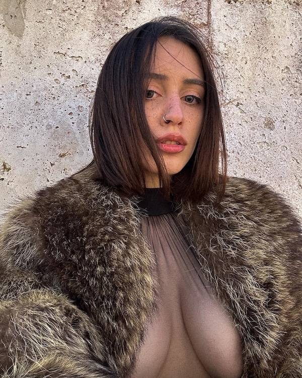 The Charm Of Freckled Faces