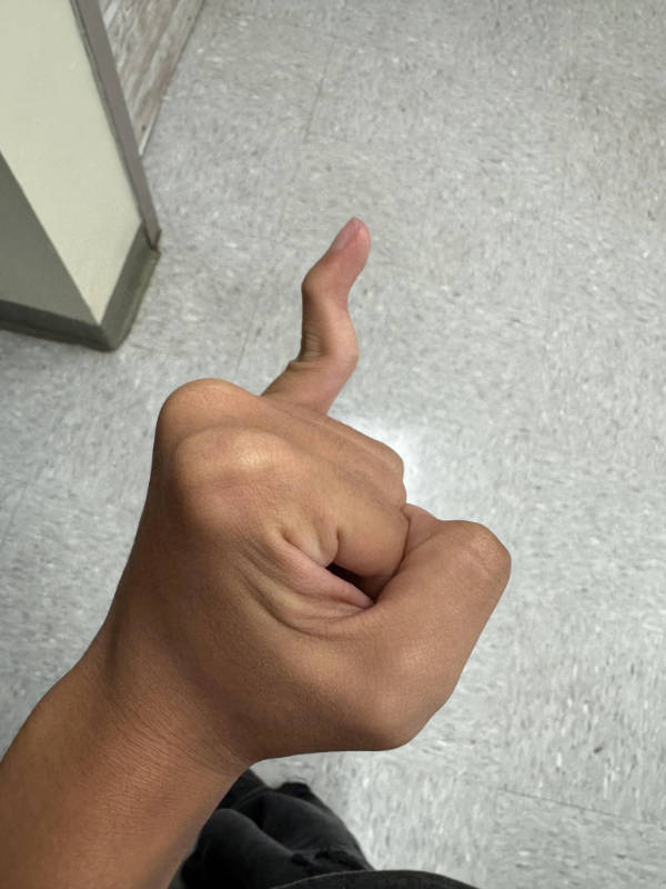 Unexpectedly Awesome Moments