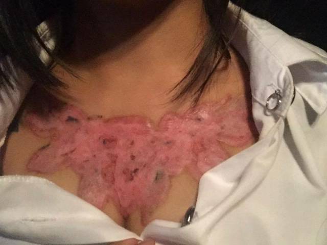 Woman Learned The Hard Way That Tattoos Can Be More Than Dangerous!
