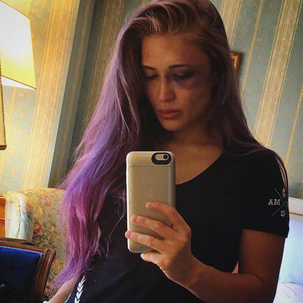 MMA Fighter Anastasia Yankova Needs Just Her Beauty To Knock You Out