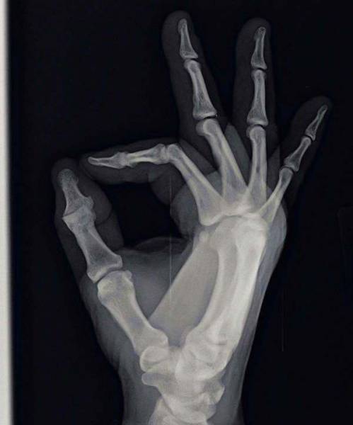 X-Rays That Will Make You Very Uncomfortable