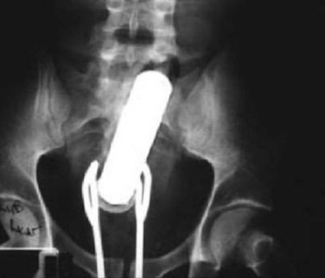 X-Rays That Will Make You Very Uncomfortable