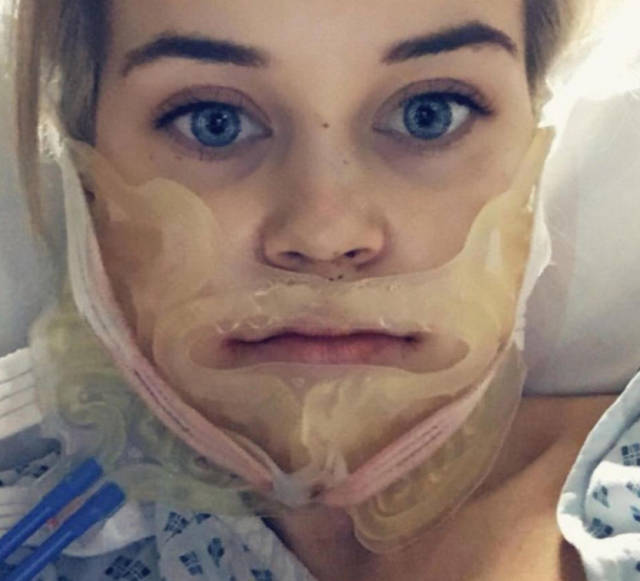 Surgery Didn’t Only Change Her Face – It Changed Her Life