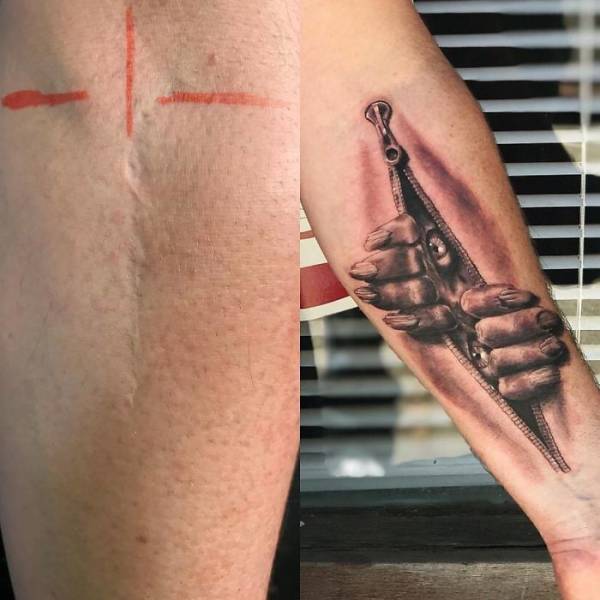 There Is No Scar That A Tattoo Artist Can’t Cover Up