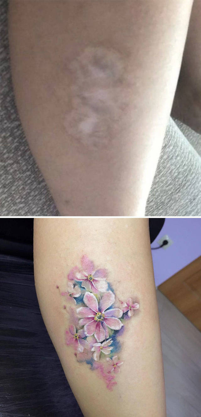 There Is No Scar That A Tattoo Artist Can’t Cover Up