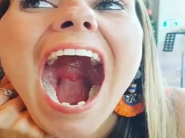 Something Is Very Wrong With Her Tongue!