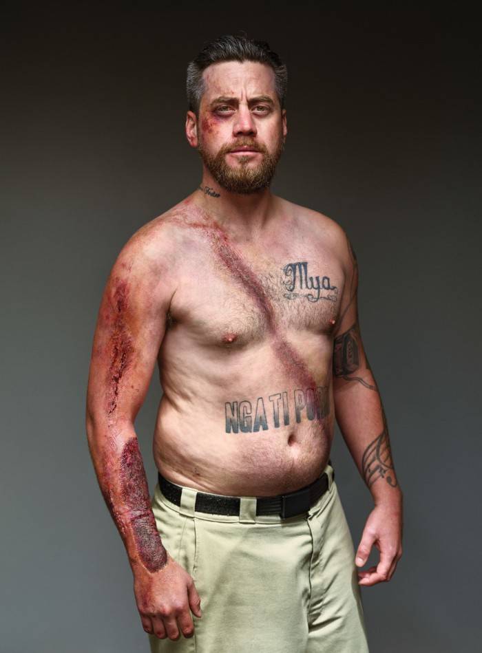 Car Crash Survivors Show The Importance Of Wearing A Seatbelt In A Powerful Social Campaign
