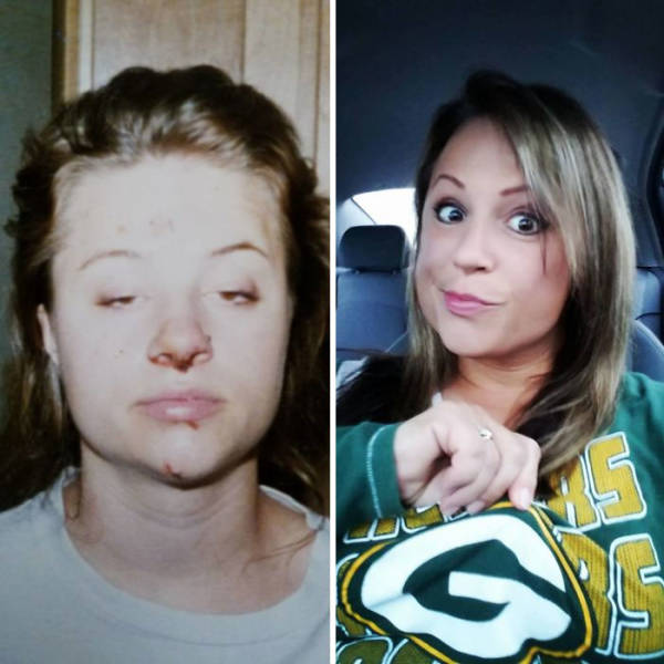 How Drug Addiction Looks Before And After