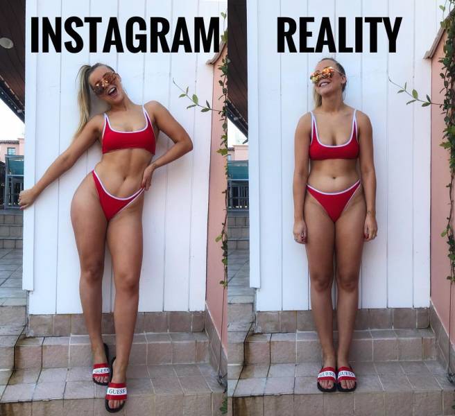 Instagram Star Teaches People To Accept Themselves And Love Their Imperfections
