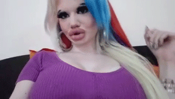 Woman Has Tripled The Size Of Her Lips And Plans On More