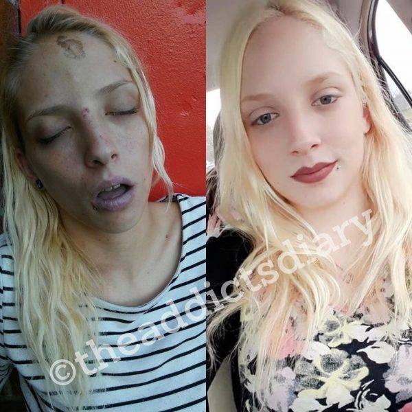 How Drug Addicts Transform After Getting Clean