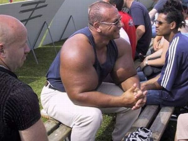 When Synthol Utilisation Goes Wrong! (53 pics)