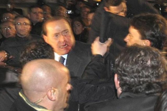 Berlusconi Gets a Broken Nose and Loses Two Teeth during the Assault (7 pics+1 video)