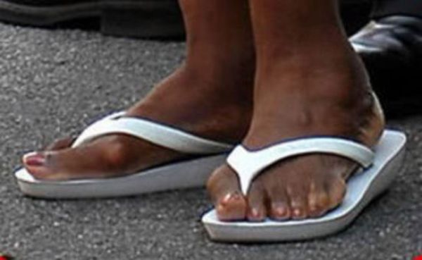 Famous Women with Ugly Feet (21 pics)