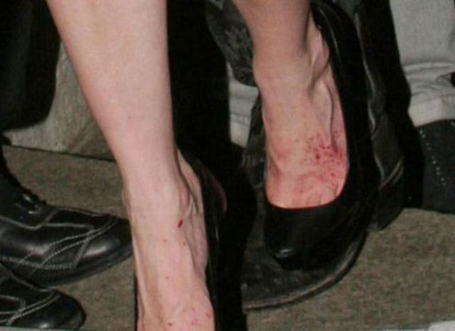 Famous Women with Ugly Feet (21 pics)