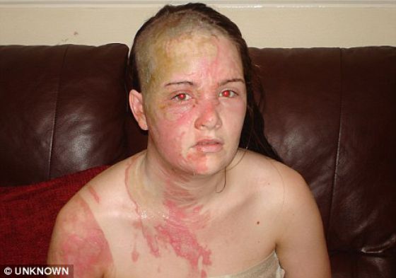 What Doctors Did to Her (4 pics)