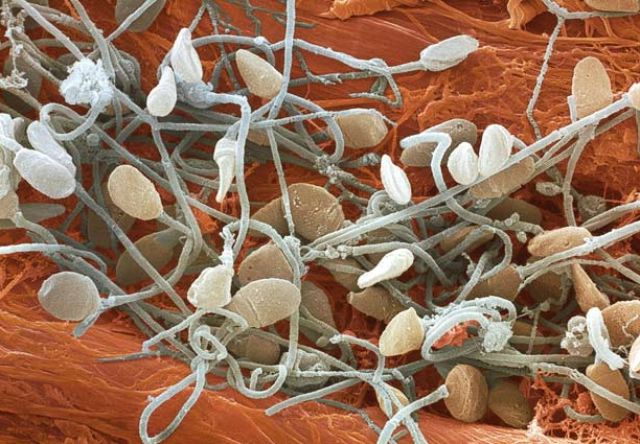 Amazing Scanning Electron Microscope Pictures