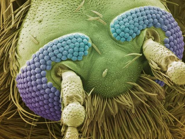Amazing Scanning Electron Microscope Pictures
