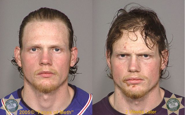 Meth Addicts: Before and After