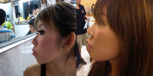 Woman Undergoes 10 Surgeries to Become Anime Character