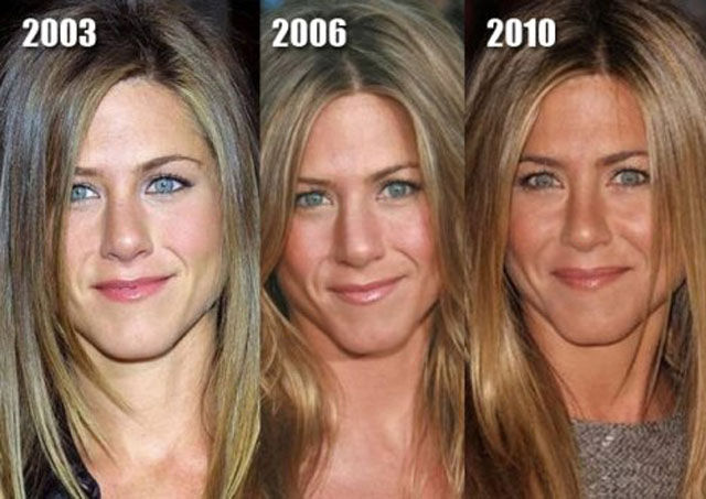 Celebrity Plastic Surgery Before After Pics Izispicy Com