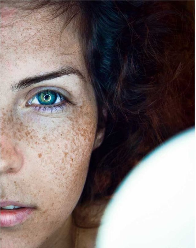 Freckles to the Front Please