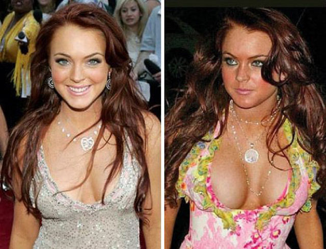 Celebs with the Worst Fake Breasts: Before and After (14 pics) -  izispicy.com