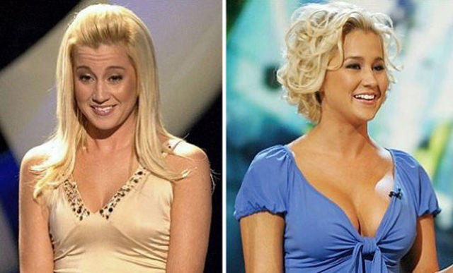 Celebs with the Worst Fake Breasts: Before and After