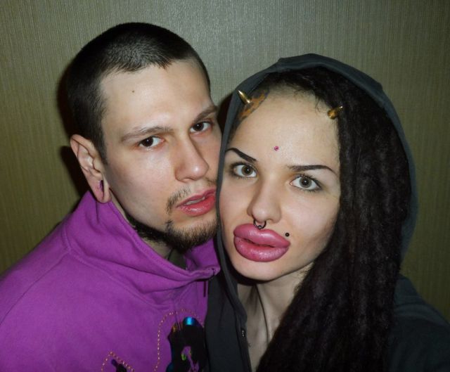 New Photos of the Girl with the World’s Largest Lips