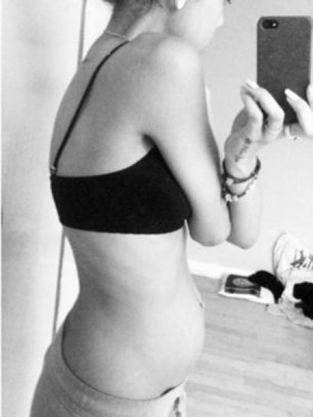 The Anorexic Pregnant Girl