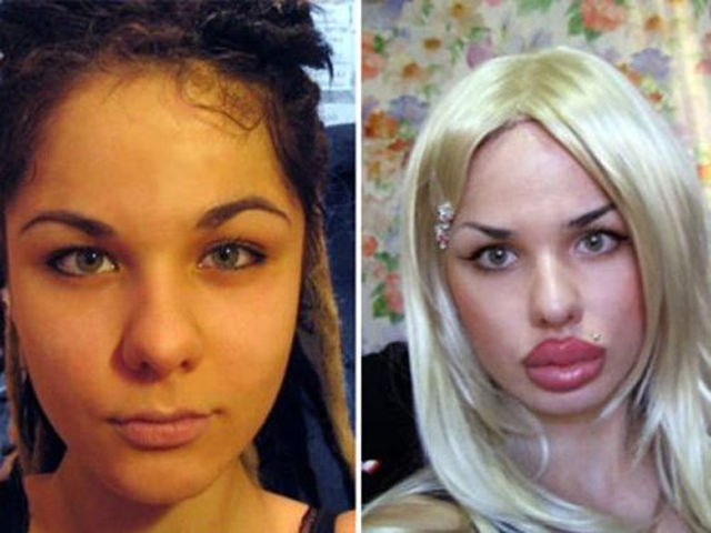 The Crazy Things Girls Do for "Beauty"