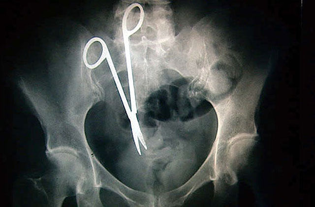 Real X-Rays That Will Shock and Astound You