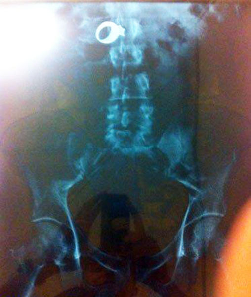 Real X-Rays That Will Shock and Astound You