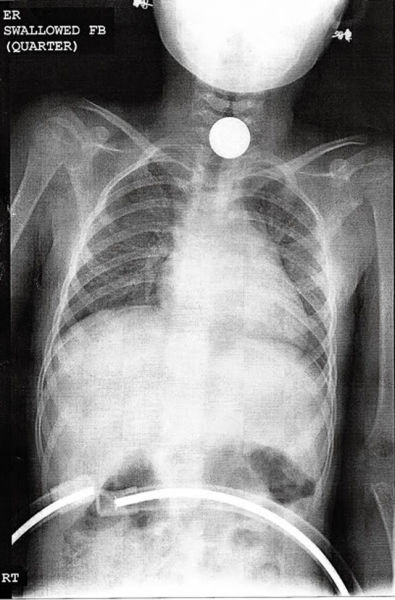 Real X Rays That Will Shock And Astound You 21 Pics Izispicy Com