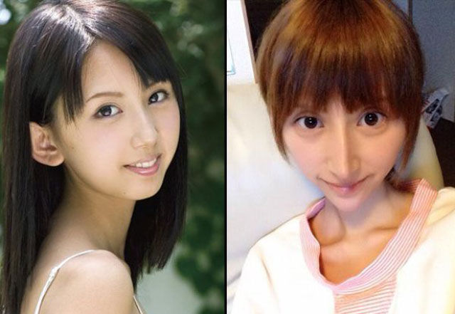 Japanese Porn Star Pre and Post Plastic Surgery