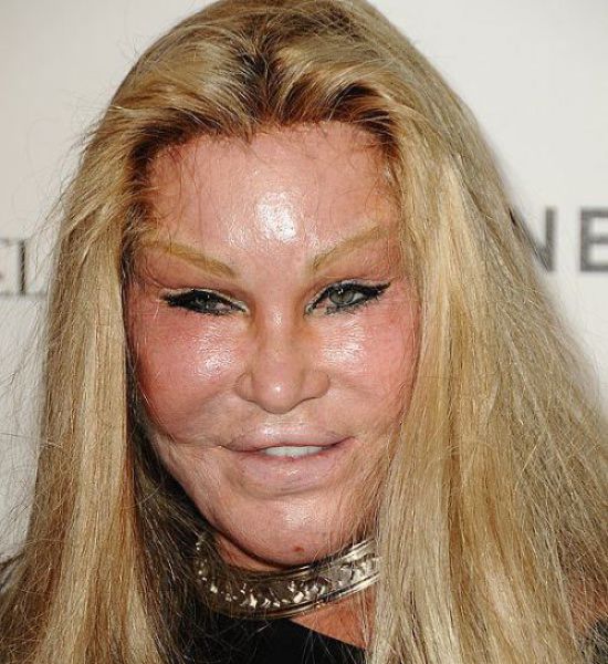 Plastic Surgery Fails That Are Just Wrong