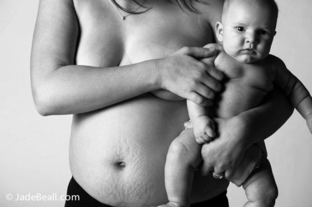 A Beautiful and Realistic Photo Story of Real Women’s Bodies after Childbirth