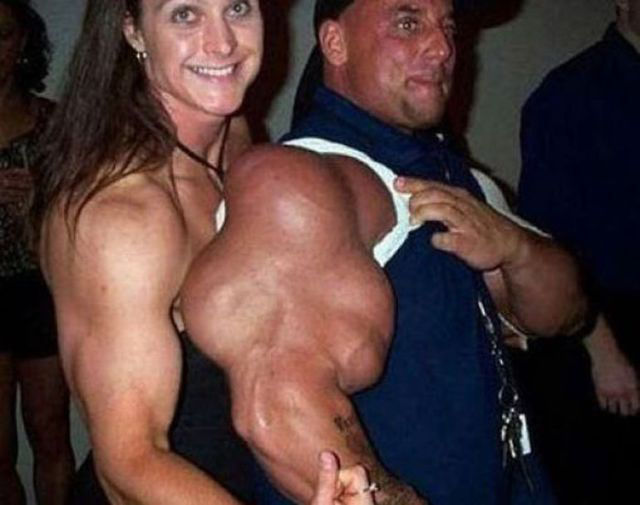 Extreme Bodybuilders Who Have Taken It a Bit Too Far