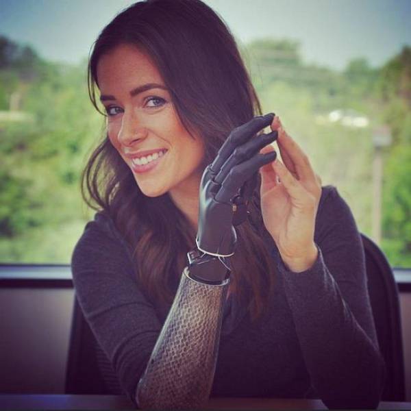This Model With A Bionic Arm Is a Natural Stunner