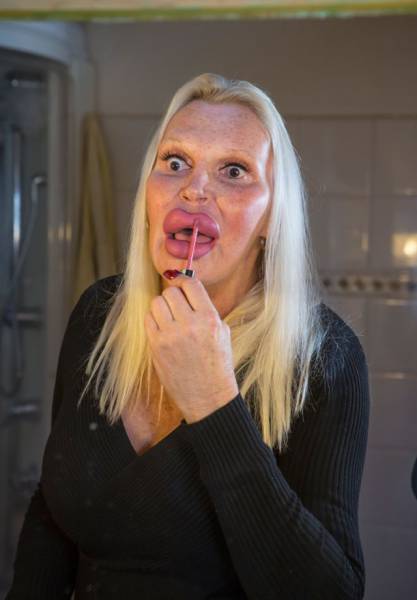 This Transgender Woman Has Taken Surgery Way Too Far