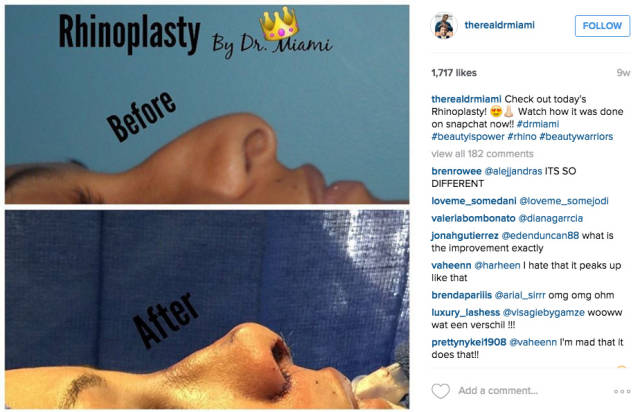 Dr. Miami Shares His Plastic Surgery Success Stories on Instagram