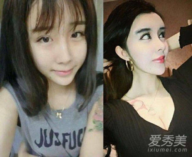 Chinese Girl Underwent Plastic Surgeries To Win Back Her Ex-Boyfriend